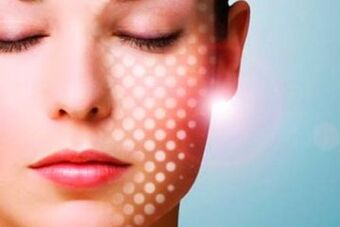 laser rejuvenation of non-ablative skin