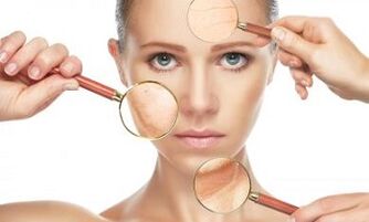 Laser fraction rejuvenation solves any skin problems